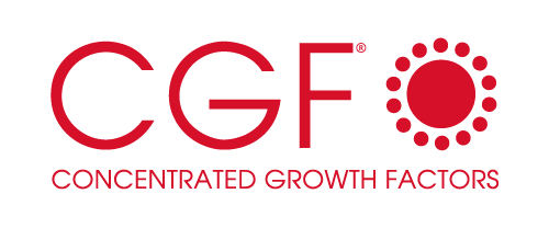 CGF